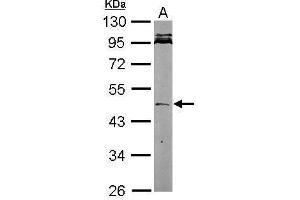 Western Blotting (WB) image for anti-Nodal Homolog (NODAL) (Center) antibody (ABIN2856412)