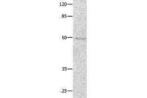 Western blot analysis of Jurkat cell, using NAP1L1 Polyclonal Antibody at dilution of 1:650 (NAP1L1 抗体)