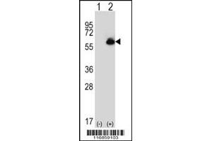 Western blot analysis of ALDH4A1 using rabbit polyclonal ALDH4A1 Antibody using 293 cell lysates (2 ug/lane) either nontransfected (Lane 1) or transiently transfected (Lane 2) with the ALDH4A1 gene. (ALDH4A1 抗体  (C-Term))