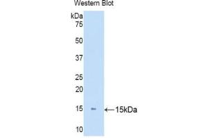 Western blot analysis of the recombinant protein. (KRT81 抗体  (AA 142-257))