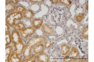 Immunoperoxidase of monoclonal antibody to SORD on formalin-fixed paraffin-embedded human kidney. (SORD 抗体  (AA 1-110))