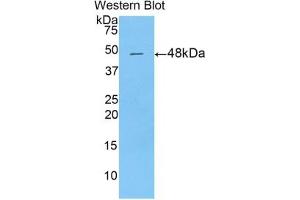 Detection of Recombinant DPT, Mouse using Polyclonal Antibody to Dermatopontin (DPT) (Dermatopontin 抗体  (AA 29-197))