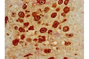 Immunohistochemistry of paraffin-embedded human placenta tissue using ABIN7156860 at dilution of 1:100 (IL22RA2 抗体  (AA 22-263))