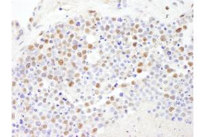 Immunohistochemistry (IHC) image for anti-Polymerase (DNA-Directed), delta 3, Accessory Subunit (POLD3) (AA 325-375) antibody (ABIN7454395)