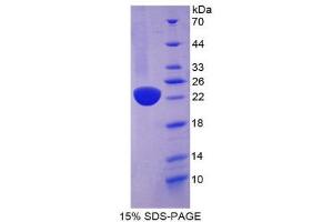 SDS-PAGE (SDS) image for Regenerating Islet-Derived 1 beta (REG1B) (AA 23-166) protein (His tag) (ABIN2126648)