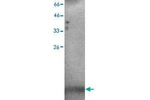 Western blot analysis of H520 whole cell lystae with C3orf10 monoclonal antibody, clone 37  at 1:500 dilution. (BRK1 抗体)