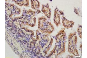 Formalin-fixed and paraffin embedded mouse intestine labeled with Rabbit Anti-HMGCR(Ser872) Polyclonal Antibody, Unconjugated  at 1:200 followed by conjugation to the secondary antibody and DAB staining (HMGCR 抗体  (pSer872))