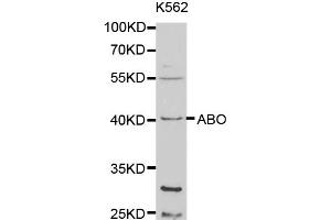 Western blot analysis of extracts of K-562 cells, using ABO antibody (ABIN5970766) at 1/1000 dilution. (ABO 抗体)