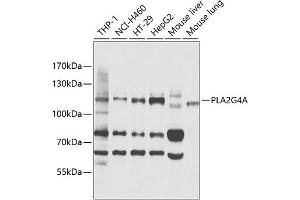 Western blot analysis of extracts of various cell lines, using PLG4A antibody (ABIN3020970, ABIN3020971, ABIN3020972 and ABIN6213833) at 1:1000 dilution. (PLA2G4A 抗体  (AA 1-180))