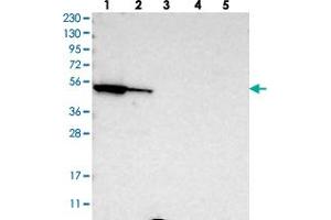 Western blot analysis of Lane 1: RT-4, Lane 2: U-251 MG, Lane 3: Human Plasma, Lane 4: Liver, Lane 5: Tonsil with FAR1 polyclonal antibody . (FAR1 抗体)