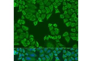 Immunofluorescence analysis of U2OS cells using Polyclonal AntibodyPC4 Polyclonal Antibody at dilution of 1:100. (SUB1 抗体)