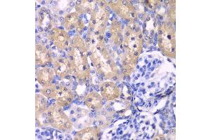 Immunohistochemistry of paraffin-embedded rat kidney using RPS6KB1 antibody at dilution of 1:100 (400x lens). (RPS6KB1 抗体)