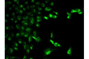 Immunofluorescence analysis of MCF-7 cell using FCGR1A antibody. (FCGR1A 抗体)