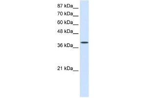 EIF4G2 antibody used at 0. (EIF4G2 抗体  (C-Term))