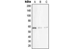 Western blot analysis of STK33 expression in A431 (A), Jurkat (B), HeLa (C) whole cell lysates. (STK33 抗体  (N-Term))