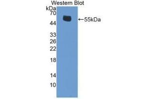 Detection of Recombinant ERb, Mouse using Polyclonal Antibody to Estrogen Receptor Beta (ERb) (ESR2 抗体  (AA 46-530))