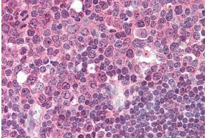 Human Tonsil (formalin-fixed, paraffin-embedded) stained with LAT2 antibody ABIN239823 at 5 ug/ml followed by biotinylated anti-mouse IgG secondary antibody ABIN481714, alkaline phosphatase-streptavidin and chromogen.