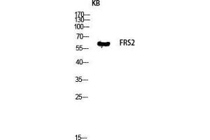 Western Blot (WB) analysis of KB lysis using FRS2 antibody. (FRS2 抗体  (Tyr580))