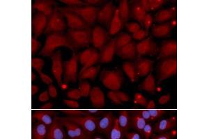 Immunofluorescence analysis of U2OS cells using BCHE Polyclonal Antibody (Butyrylcholinesterase 抗体)