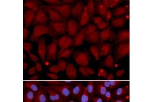 Immunofluorescence analysis of U2OS cells using BCHE Polyclonal Antibody (Butyrylcholinesterase 抗体)