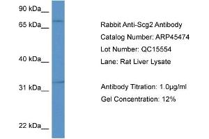 Western Blotting (WB) image for anti-Secretogranin II (SCG2) (Middle Region) antibody (ABIN2782232) (SCG2 抗体  (Middle Region))
