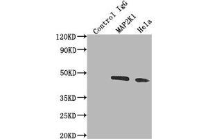 Immunoprecipitating MAP2K1 in Hela whole cell lysate Lane 1: Rabbit control IgG instead of ABIN7127612 in Hela whole cell lysate. (Recombinant MEK1 抗体)