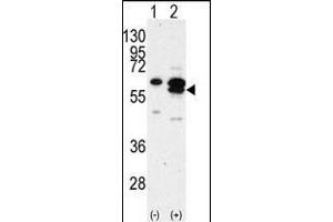 Western blot analysis of CK1G (arrow) using rabbit polyclonal CK1G Antibody (C-term) (R). (CAMK1G 抗体  (C-Term))