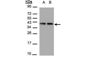 WB Image Sample(30 μg of whole cell lysate) A:A431, B:H1299 12% SDS PAGE antibody diluted at 1:1500 (TBCC 抗体)