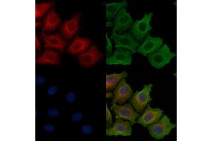 ABIN6257616 and ABIN6275245 staining Hela cells by IF/ICC.