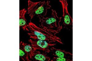 Immunofluorescence (IF) image for anti-T Antigen antibody (ABIN3001361) (T Antigen 抗体)