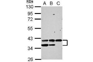 WB Image Sample (30 ug of whole cell lysate) A: 293T B: A431 C: HepG2 10% SDS PAGE antibody diluted at 1:1000 (VEGFA 抗体  (C-Term))