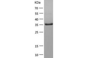 Western Blotting (WB) image for Protein tyrosine Phosphatase, Non-Receptor Type 7 (PTPN7) (AA 1-360) protein (His tag) (ABIN7124682) (PTPN7 Protein (AA 1-360) (His tag))