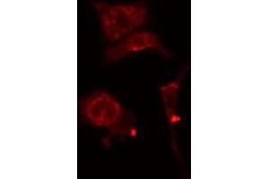 ABIN6277179 staining  Hela cells by IF/ICC. (DLGAP5 抗体  (N-Term))