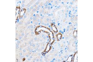 Immunohistochemistry of paraffin-embedded Mouse kidney using p38 MAPK Rabbit pAb (ABIN7268615) at dilution of 1:100 (40x lens). (MAPK14 抗体  (AA 1-360))
