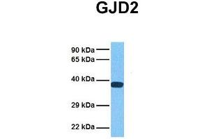 Host:  Rabbit  Target Name:  GJD2  Sample Tissue:  Human 293T  Antibody Dilution:  1. (GJD2 抗体  (Middle Region))