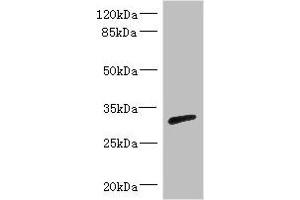 Western blot All lanes: RPIA antibody IgG at 3. (Ribose 5-Phosphate Isomerase A (RPIA) (AA 82-311) 抗体)