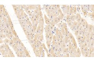 Detection of CD40L in Human Cardiac Muscle Tissue using Monoclonal Antibody to Cluster Of Differentiation 40 Ligand (CD40L) (CD40 Ligand 抗体  (AA 180-261))