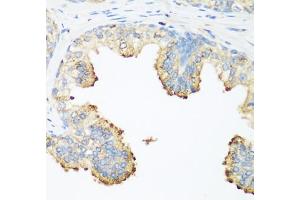 Immunohistochemistry of paraffin-embedded human prostate using PLEK antibody (ABIN6290796) at dilution of 1:200 (40x lens). (Pleckstrin 抗体)