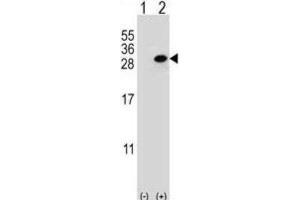 Western Blotting (WB) image for anti-Clathrin, Light Chain A (CLTA) antibody (ABIN3004002) (CLTA 抗体)