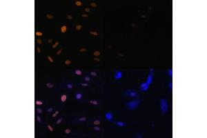 Immunofluorescence analysis of NIH/3T3 cells using Acetyl-Histone H3-K23 (ABIN7267669) at dilution of 1:100.