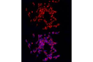 Immunofluorescence analysis of SH-SY5Y cells using CART Rabbit pAb (ABIN6131305, ABIN6137949, ABIN6137950 and ABIN6221042) at dilution of 1:250 (40x lens). (CARTPT 抗体  (AA 28-116))