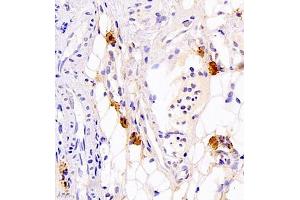 Immunohistochemistry of paraffin embedded rat thyroid gland using Calcitonin (ABIN7073271) at dilution of 1:700 (400x lens) (Calcitonin 抗体)