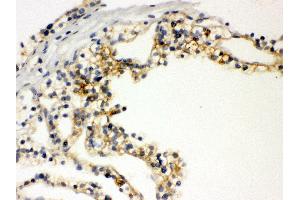 Immunohistochemistry (IHC) image for anti-Solute Carrier Family 12 (Sodium/potassium/chloride Transporters), Member 1 (SLC12A1) (AA 52-83), (N-Term) antibody (ABIN3043925)