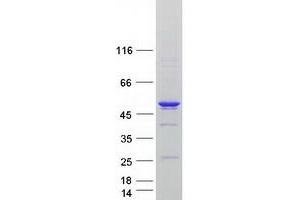 Western Blotting (WB) image for Aurora Kinase A (AURKA) (Transcript Variant 5) protein (Myc-DYKDDDDK Tag) (ABIN2715081)