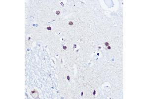 Immunohistochemistry of paraffin-embedded human brain using 53BP1 Rabbit pAb (ABIN6128833, ABIN6149414, ABIN6149415 and ABIN6221431) at dilution of 1:100 (40x lens). (TP53BP1 抗体  (AA 1763-1977))