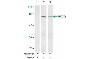 Western blot analysis of exreacts from HT-29 and K-562 cells untreated or treated with anisomycin (1mM, 30 min) using PRKCQ polyclonal antibody . (PKC theta 抗体)