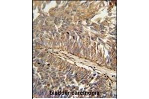 Immunohistochemistry (Paraffin-embedded Sections) (IHC (p)) image for anti-ATPase Type 13A3 (ATP13A3) (AA 101-129), (N-Term) antibody (ABIN652119)