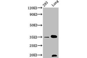 Western Blot Positive WB detected in: 293 whole cell lysate, Mouse lung tissue All lanes: CNN1 antibody at 1. (Recombinant CNN1 抗体)