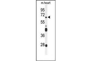 Western blot analysis of FZD4 Antibody (C-term) in mouse heart tissue lysates (35ug/lane). (FZD4 抗体  (C-Term))