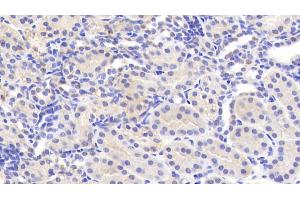 Detection of CEACAM1 in Human Kidney Tissue using Polyclonal Antibody to Carcinoembryonic Antigen Related Cell Adhesion Molecule 1 (CEACAM1) (CEACAM1 抗体)